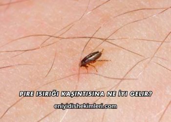 Pire Isırığı Kaşıntısına Ne İyi Gelir?