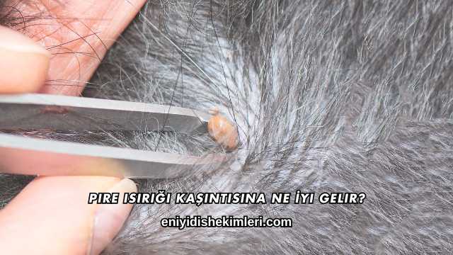 Pire Isırığı Kaşıntısına Ne İyi Gelir?