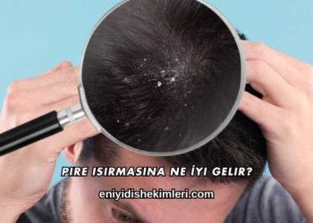 Pire Isırmasına Ne İyi Gelir?