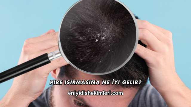 Pire Isırmasına Ne İyi Gelir?