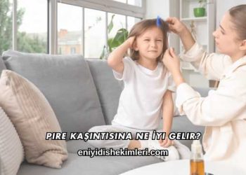 Pire Kaşıntısına Ne İyi Gelir?