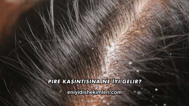 Pire Kaşıntısına Ne İyi Gelir?