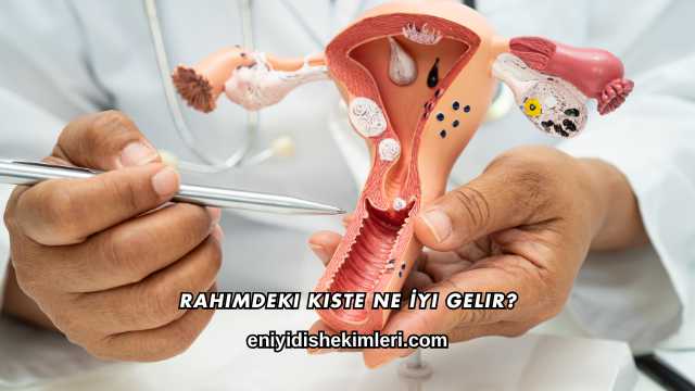 Rahimdeki Kiste Ne İyi Gelir?
