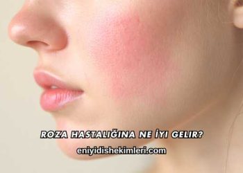 Roza Hastalığına Ne İyi Gelir?