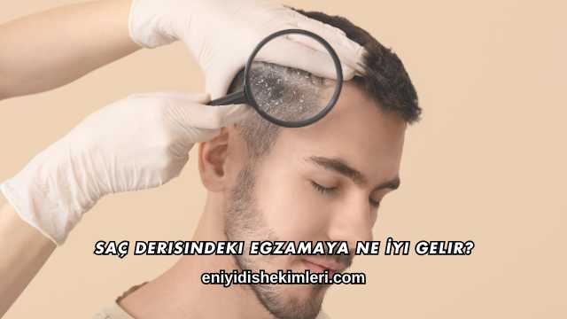 Saç Derisindeki Egzamaya Ne İyi Gelir?