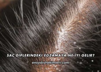Saç Diplerindeki Egzamaya Ne İyi Gelir?