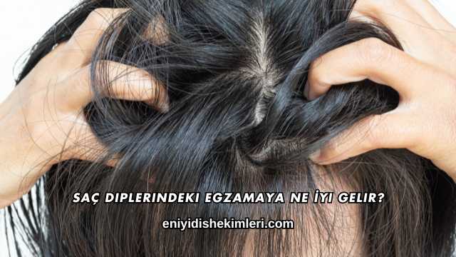 Saç Diplerindeki Egzamaya Ne İyi Gelir?