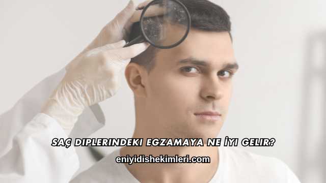 Saç Diplerindeki Egzamaya Ne İyi Gelir?