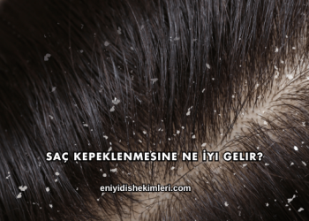 Saç Kepeklenmesine Ne İyi Gelir?
