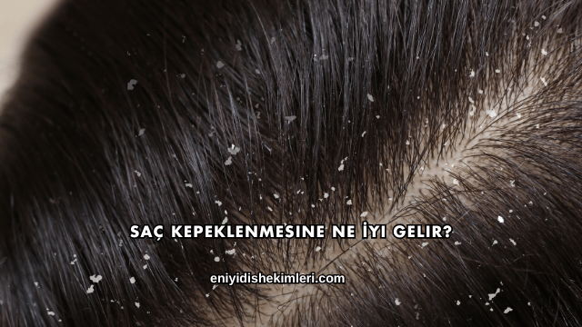 Saç Kepeklenmesine Ne İyi Gelir?