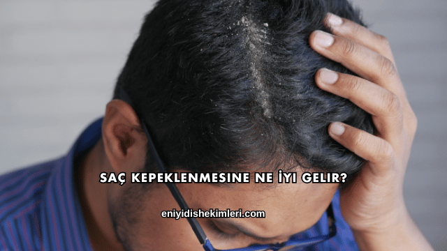 Saç Kepeklenmesine Ne İyi Gelir?