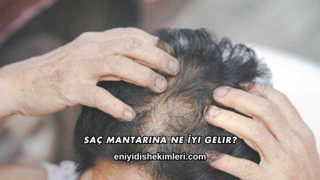 Saç Mantarına Ne İyi Gelir?