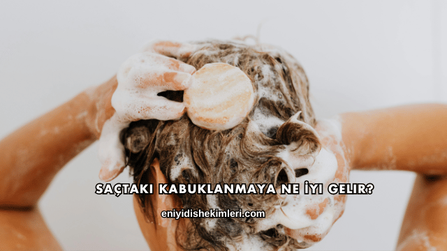 Saçtaki Kabuklanmaya Ne İyi Gelir?