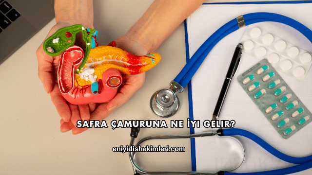 Safra Çamuruna Ne İyi Gelir?