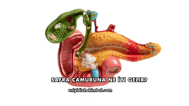 Safra Çamuruna Ne İyi Gelir?