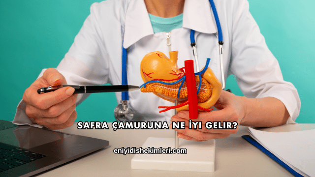 Safra Çamuruna Ne İyi Gelir?