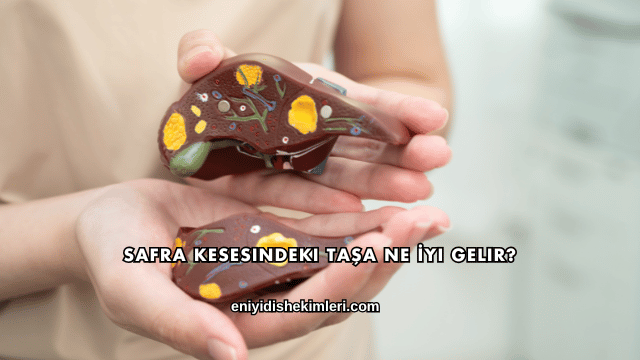 Safra Kesesindeki Taşa Ne İyi Gelir?