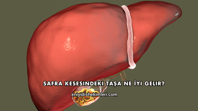 Safra Kesesindeki Taşa Ne İyi Gelir?