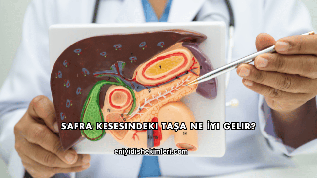 Safra Kesesindeki Taşa Ne İyi Gelir?