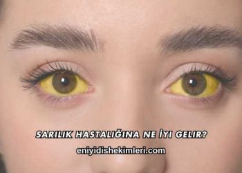 Sarılık Hastalığına Ne İyi Gelir?