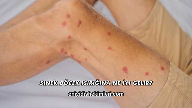 Sinek Böcek Isırığına Ne İyi Gelir?