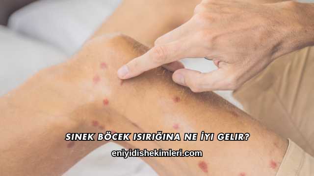 Sinek Böcek Isırığına Ne İyi Gelir?