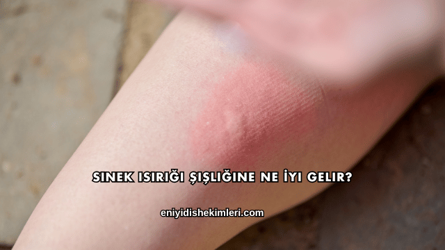 Sinek Isırığı Şişliğine Ne İyi Gelir?