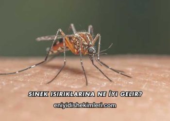 Sinek Isırıklarına Ne İyi Gelir?