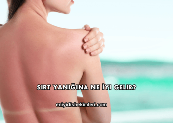 Sırt Yanığına Ne İyi Gelir?