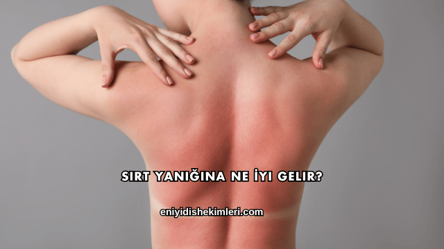 Sırt Yanığına Ne İyi Gelir?