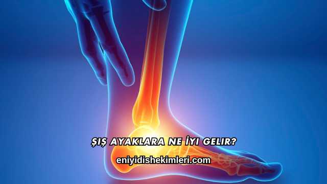 Şiş Ayaklara Ne İyi Gelir?