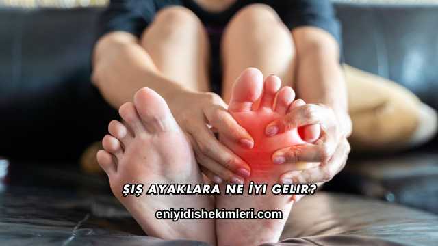Şiş Ayaklara Ne İyi Gelir?