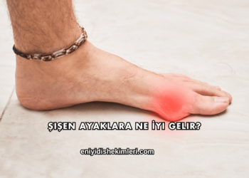 Şişen Ayaklara Ne İyi Gelir?