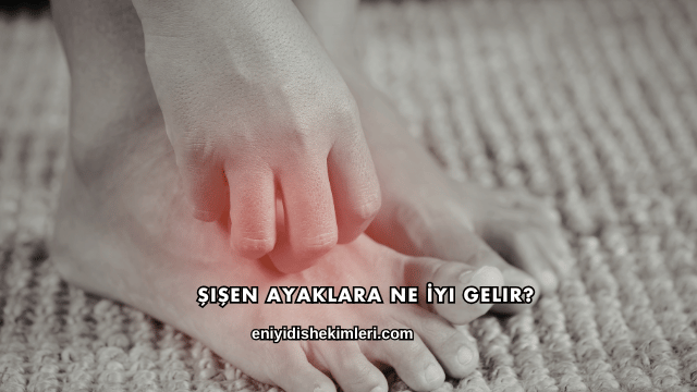 Şişen Ayaklara Ne İyi Gelir?