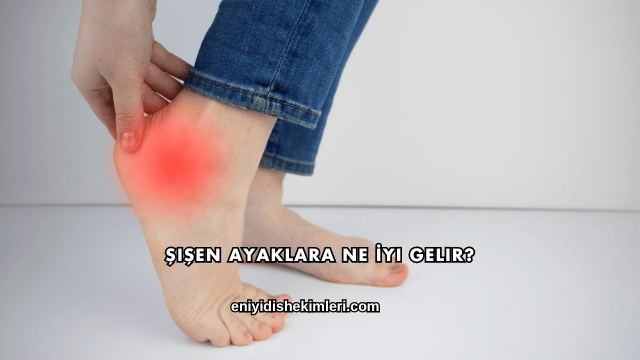 Şişen Ayaklara Ne İyi Gelir?
