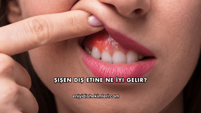 Şişen Diş Etine Ne İyi Gelir?