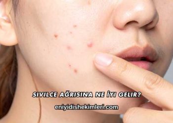 Sivilce Ağrısına Ne İyi Gelir?