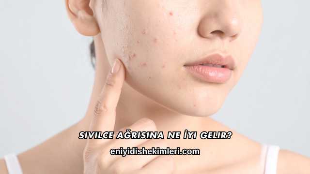 Sivilce Ağrısına Ne İyi Gelir?