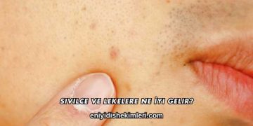 Sivilce ve Lekelere Ne İyi Gelir?