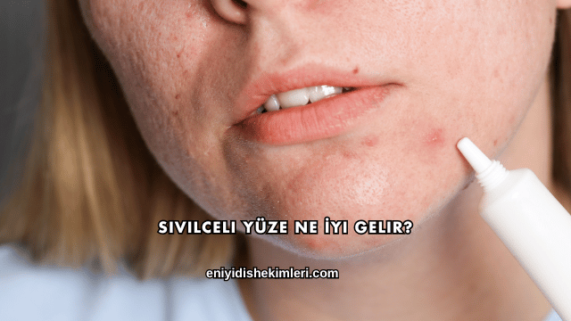 Sivilceli Yüze Ne İyi Gelir?