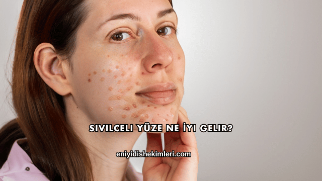 Sivilceli Yüze Ne İyi Gelir?