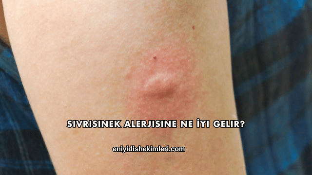 Sivrisinek Alerjisine Ne İyi Gelir?