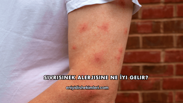 Sivrisinek Alerjisine Ne İyi Gelir?