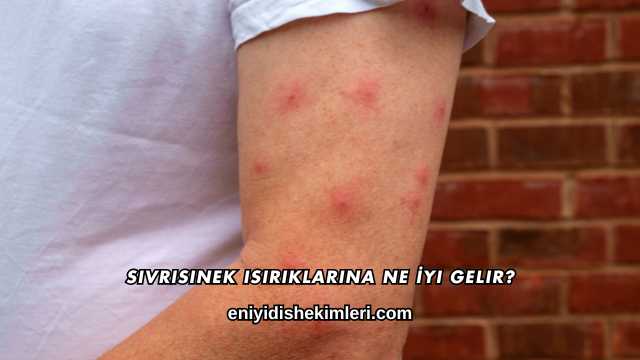Sivrisinek Isırıklarına Ne İyi Gelir?