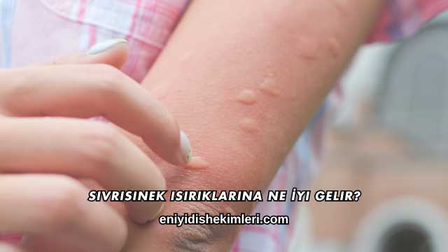 Sivrisinek Isırıklarına Ne İyi Gelir?