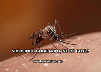 Sivrisinek Yaralarına Ne İyi Gelir?