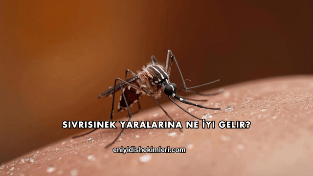Sivrisinek Yaralarına Ne İyi Gelir?