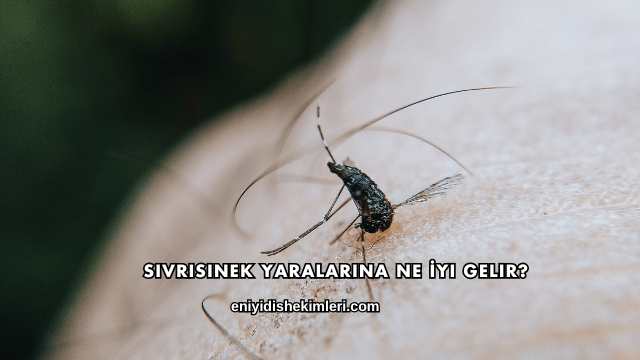 Sivrisinek Yaralarına Ne İyi Gelir?