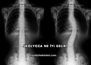 Skolyoza Ne İyi Gelir?