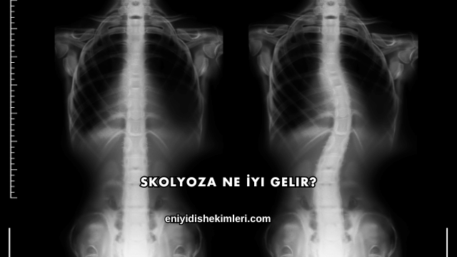 Skolyoza Ne İyi Gelir?